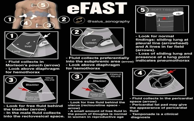 FAST Exam